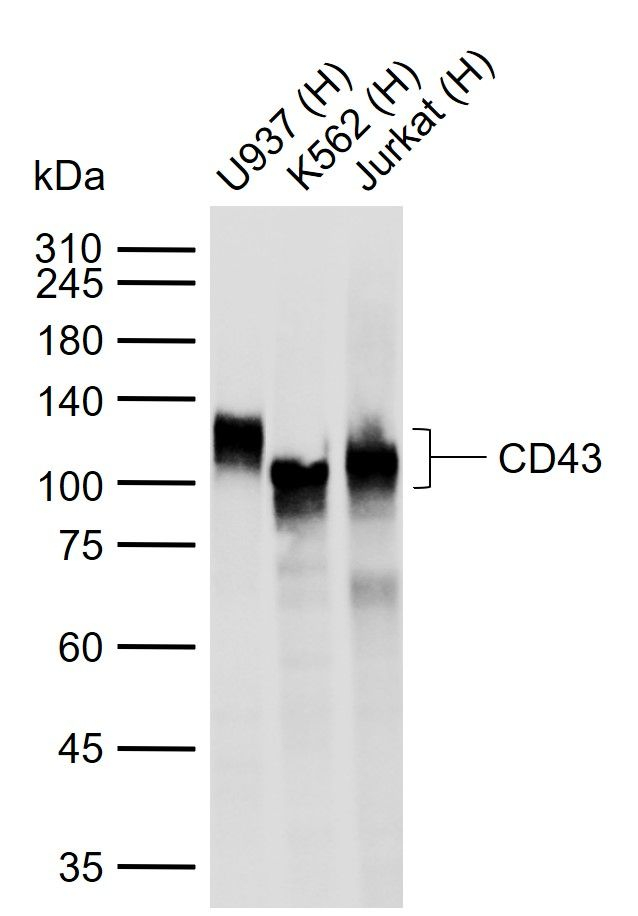 CD43 Antibody in Western Blot (WB)