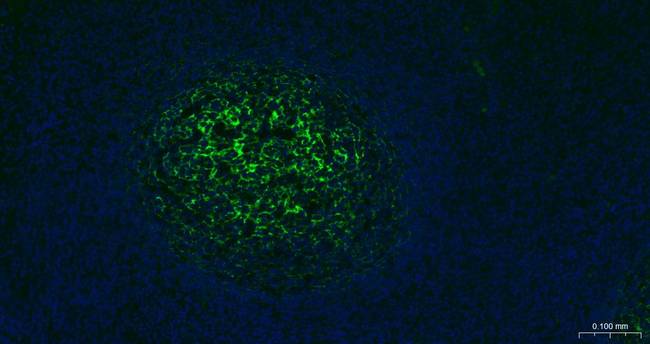 CD35 Antibody in Immunohistochemistry (Paraffin) (IHC (P))