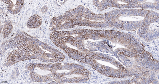 Claudin 1 Antibody in Immunohistochemistry (Paraffin) (IHC (P))