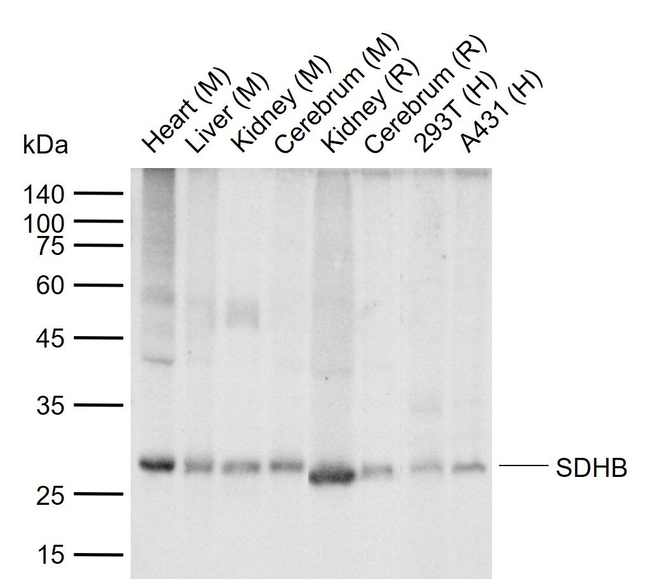 SDHB Antibody in Western Blot (WB)