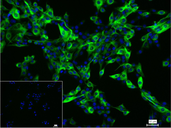 Desmin Antibody in Immunocytochemistry (ICC/IF)