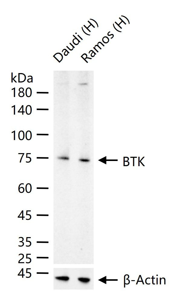 BTK Antibody in Western Blot (WB)