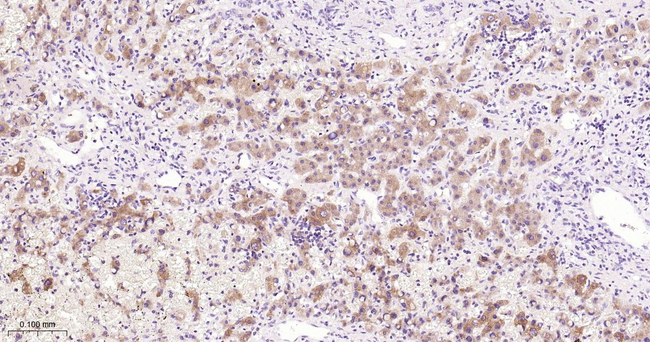 Tensin 4 Antibody in Immunohistochemistry (Paraffin) (IHC (P))