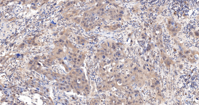 MAGE1 Antibody in Immunohistochemistry (Paraffin) (IHC (P))