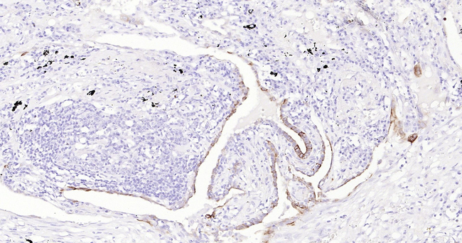MUC4 Antibody in Immunohistochemistry (Paraffin) (IHC (P))