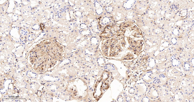 Galectin 1 Antibody in Immunohistochemistry (Paraffin) (IHC (P))