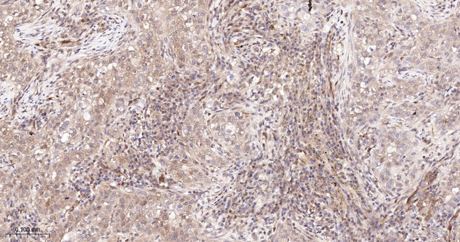 Caspase 7 Antibody in Immunohistochemistry (Paraffin) (IHC (P))