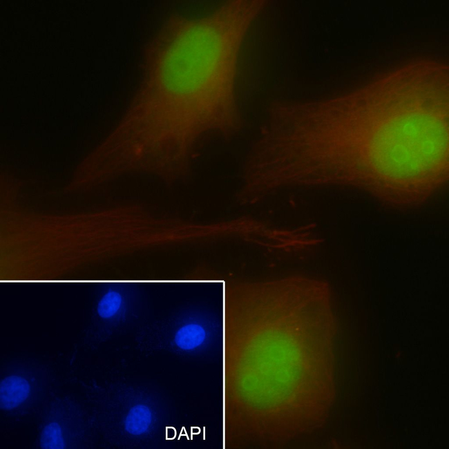 p16INK4a Antibody in Immunocytochemistry (ICC/IF)