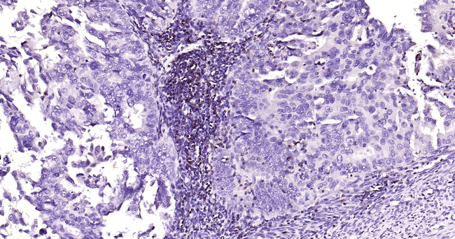 CD2 Antibody in Immunohistochemistry (Paraffin) (IHC (P))