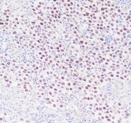 SALL4 Antibody in Immunohistochemistry (Paraffin) (IHC (P))