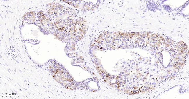 SPINK1 Antibody in Immunohistochemistry (Paraffin) (IHC (P))