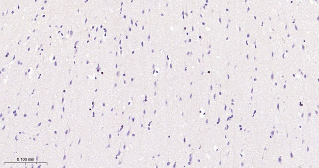 SOX10 Antibody in Immunohistochemistry (Paraffin) (IHC (P))