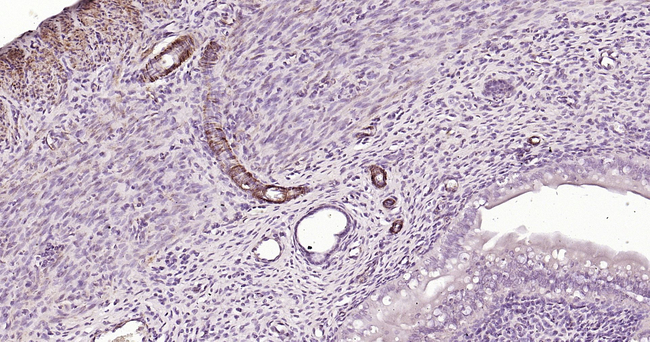 Caldesmon Antibody in Immunohistochemistry (Paraffin) (IHC (P))