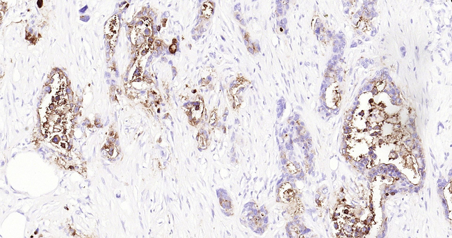 CD66a Antibody in Immunohistochemistry (Paraffin) (IHC (P))