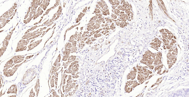 Pan Actin Antibody in Immunohistochemistry (Paraffin) (IHC (P))