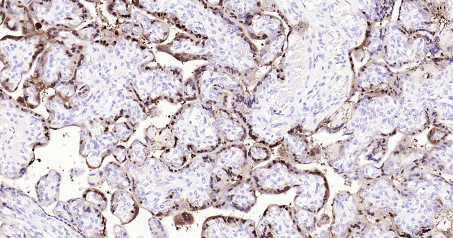 S100P Antibody in Immunohistochemistry (Paraffin) (IHC (P))