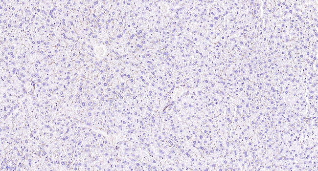 CD13 Antibody in Immunohistochemistry (Paraffin) (IHC (P))