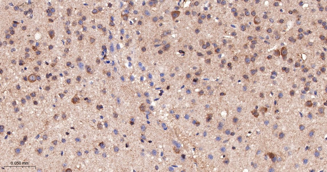HIP Antibody in Immunohistochemistry (Paraffin) (IHC (P))