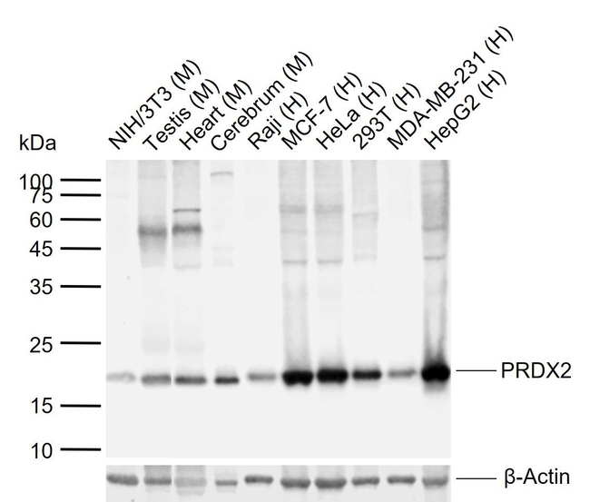 PRDX2 Antibody in Western Blot (WB)