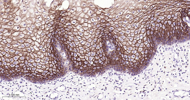 TROP2 Antibody in Immunohistochemistry (Paraffin) (IHC (P))