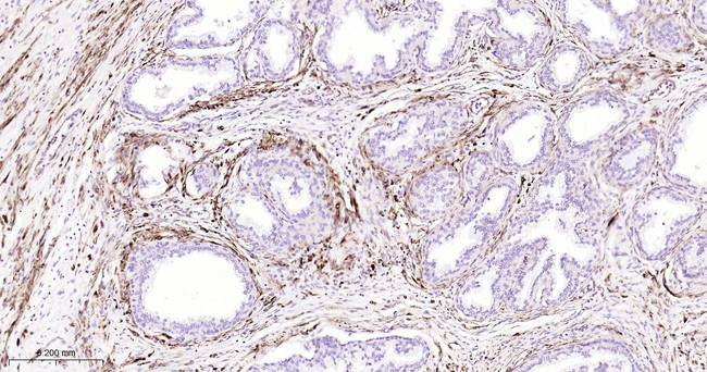 AMACR Antibody in Immunohistochemistry (Paraffin) (IHC (P))