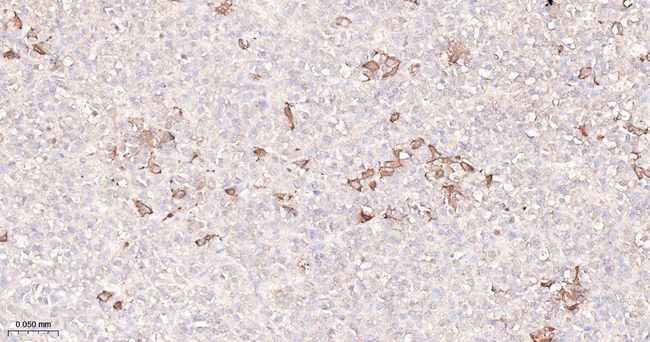 TSH beta Antibody in Immunohistochemistry (Paraffin) (IHC (P))