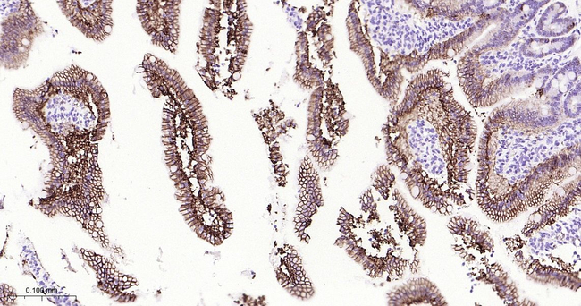 CDH17 Antibody in Immunohistochemistry (Paraffin) (IHC (P))