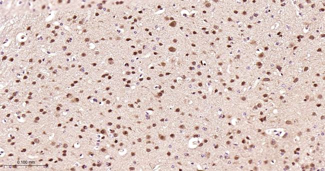 DYNLL1 Antibody in Immunohistochemistry (Paraffin) (IHC (P))