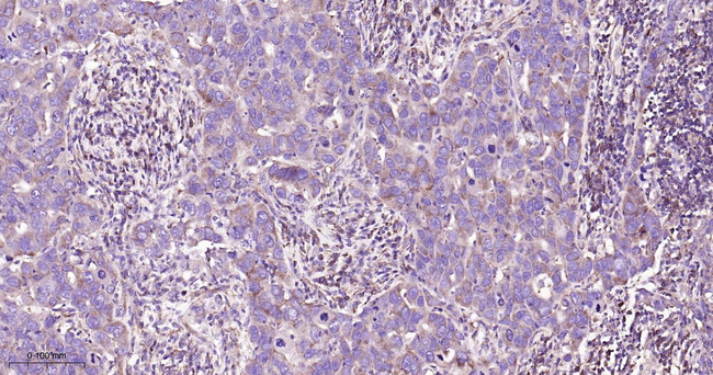 ABCE1 Antibody in Immunohistochemistry (Paraffin) (IHC (P))