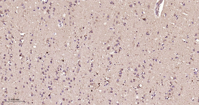 PTPN2 Antibody in Immunohistochemistry (Paraffin) (IHC (P))