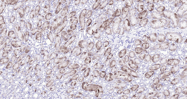 Catalase Antibody in Immunohistochemistry (Paraffin) (IHC (P))