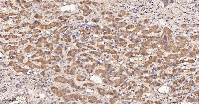 PCK2 Antibody in Immunohistochemistry (Paraffin) (IHC (P))
