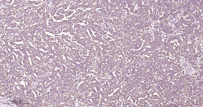 HSPE1 Antibody in Immunohistochemistry (Paraffin) (IHC (P))