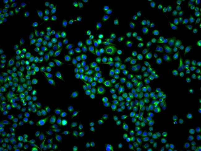 BAP31 Antibody in Immunocytochemistry (ICC/IF)