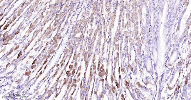 ACADM Antibody in Immunohistochemistry (Paraffin) (IHC (P))