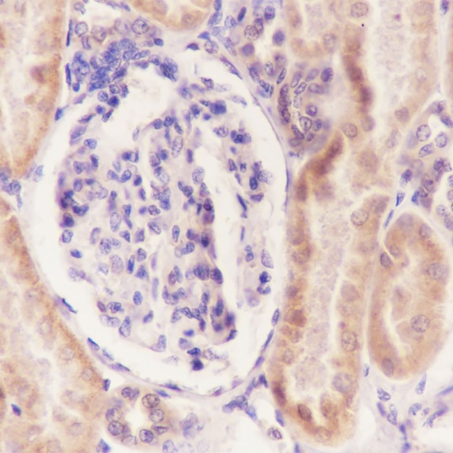 RPS20 Antibody in Immunohistochemistry (Paraffin) (IHC (P))