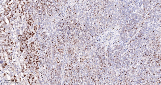 MCM5 Antibody in Immunohistochemistry (Paraffin) (IHC (P))