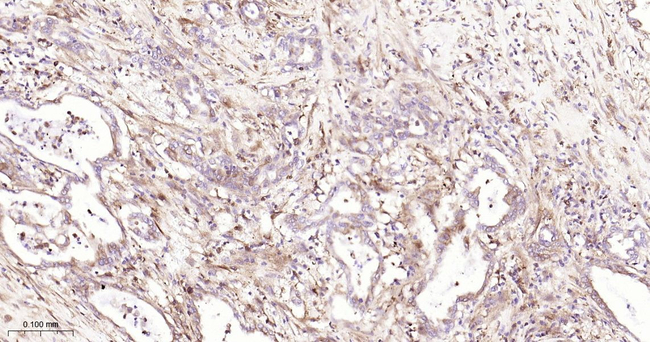 PGAM1 Antibody in Immunohistochemistry (Paraffin) (IHC (P))