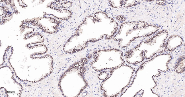 PRMT5 Antibody in Immunohistochemistry (Paraffin) (IHC (P))