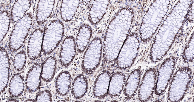 PTBP2 Antibody in Immunohistochemistry (Paraffin) (IHC (P))