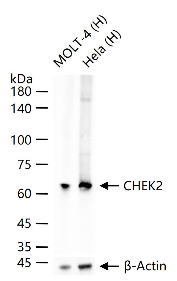 CHK2 Antibody in Western Blot (WB)