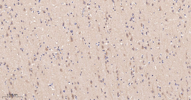 GRK2 Antibody in Immunohistochemistry (Paraffin) (IHC (P))