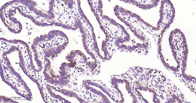 PHGDH Antibody in Immunohistochemistry (Paraffin) (IHC (P))
