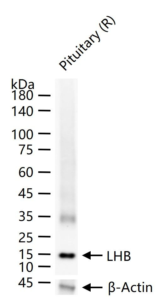 LH-beta Antibody in Western Blot (WB)