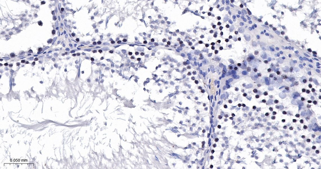 SUV39H2 Antibody in Immunohistochemistry (Paraffin) (IHC (P))