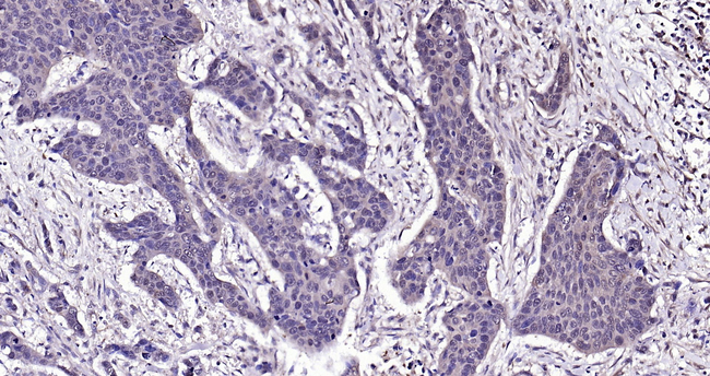 GSTP1 Antibody in Immunohistochemistry (Paraffin) (IHC (P))