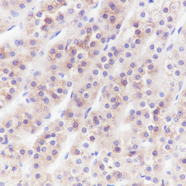 INHA Antibody in Immunohistochemistry (Paraffin) (IHC (P))