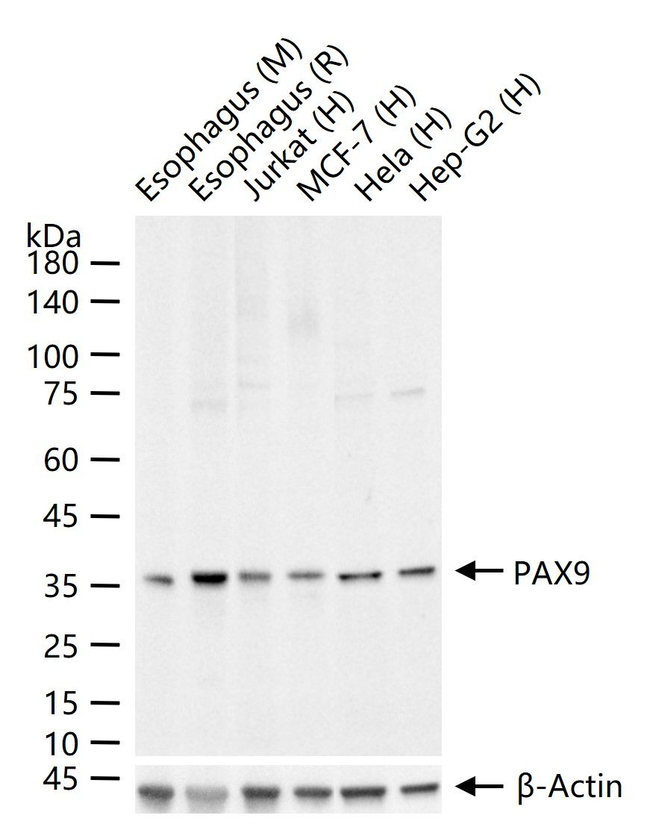 Pax Rabbit PAX9 Recombinant Rabbit Monoclonal Antibody (G12B2) (MA572191)