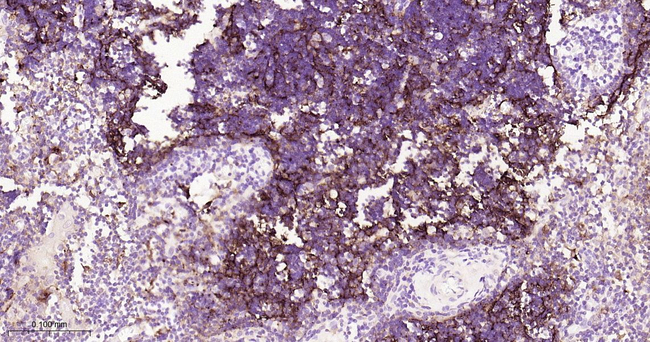 CD205 Antibody in Immunohistochemistry (Paraffin) (IHC (P))