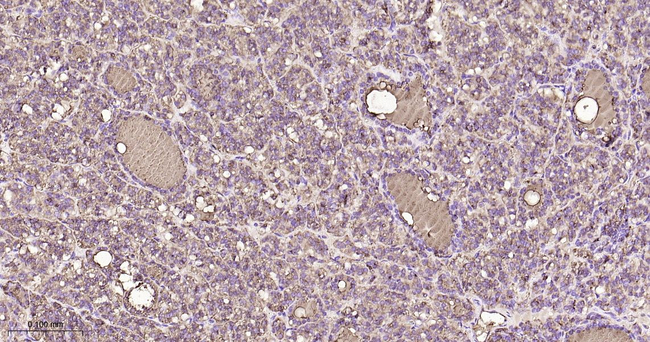 Thyroglobulin Antibody in Immunohistochemistry (Paraffin) (IHC (P))